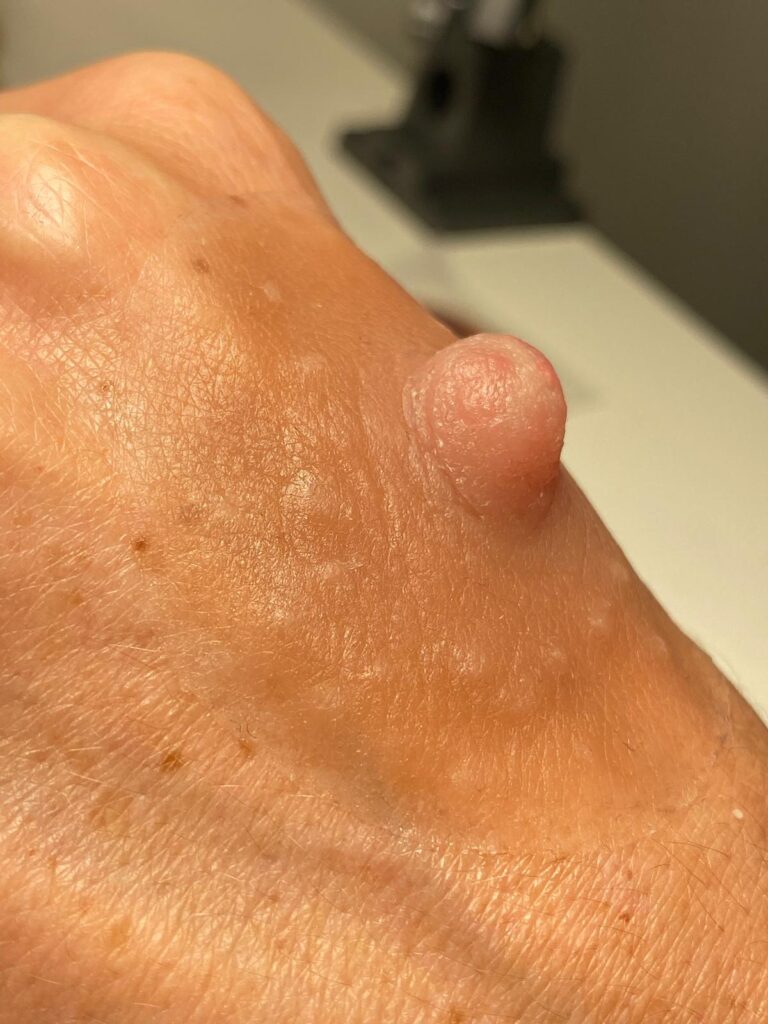 mano